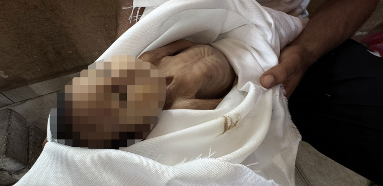 Gazze’de soğuk hava ve çevre kirliliği, 17 yıl beklenen bebeği hayattan kopardı