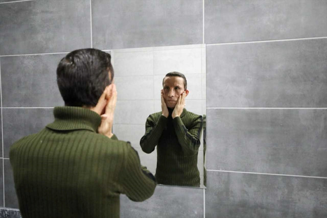 Türkiye'nin ilk yüz naklinin 14. yılı kutlandı - Resim: 2