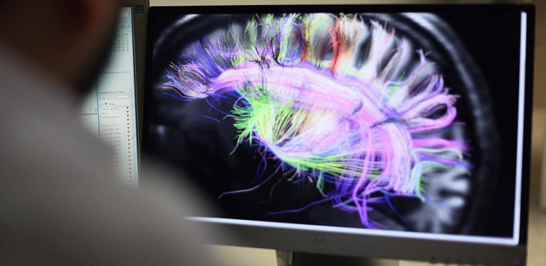 Bencilliğin çaresi bulunmuş olabilir: Beyinde gama senkronizasyonu